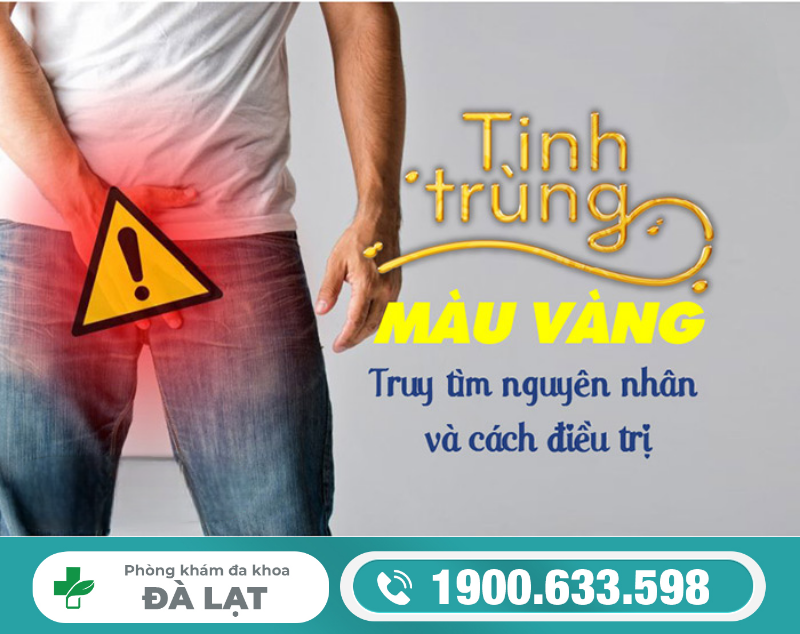 Hình ảnh minh họa